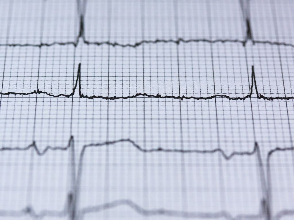 Pulse monitor readout